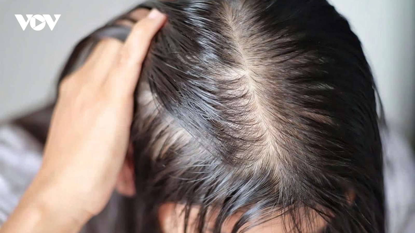 Tóc ngày càng thưa mỏng, rụng nhiều: Phụ nữ cần làm gì để giữ mái tóc khỏe đẹp?