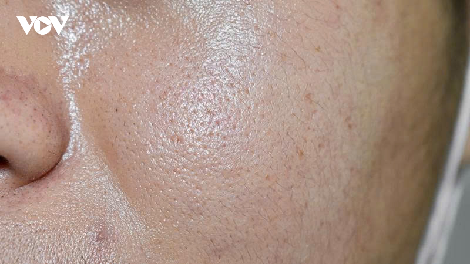 6 sai lầm khi chăm sóc da dầu khiến da càng đổ nhiều dầu