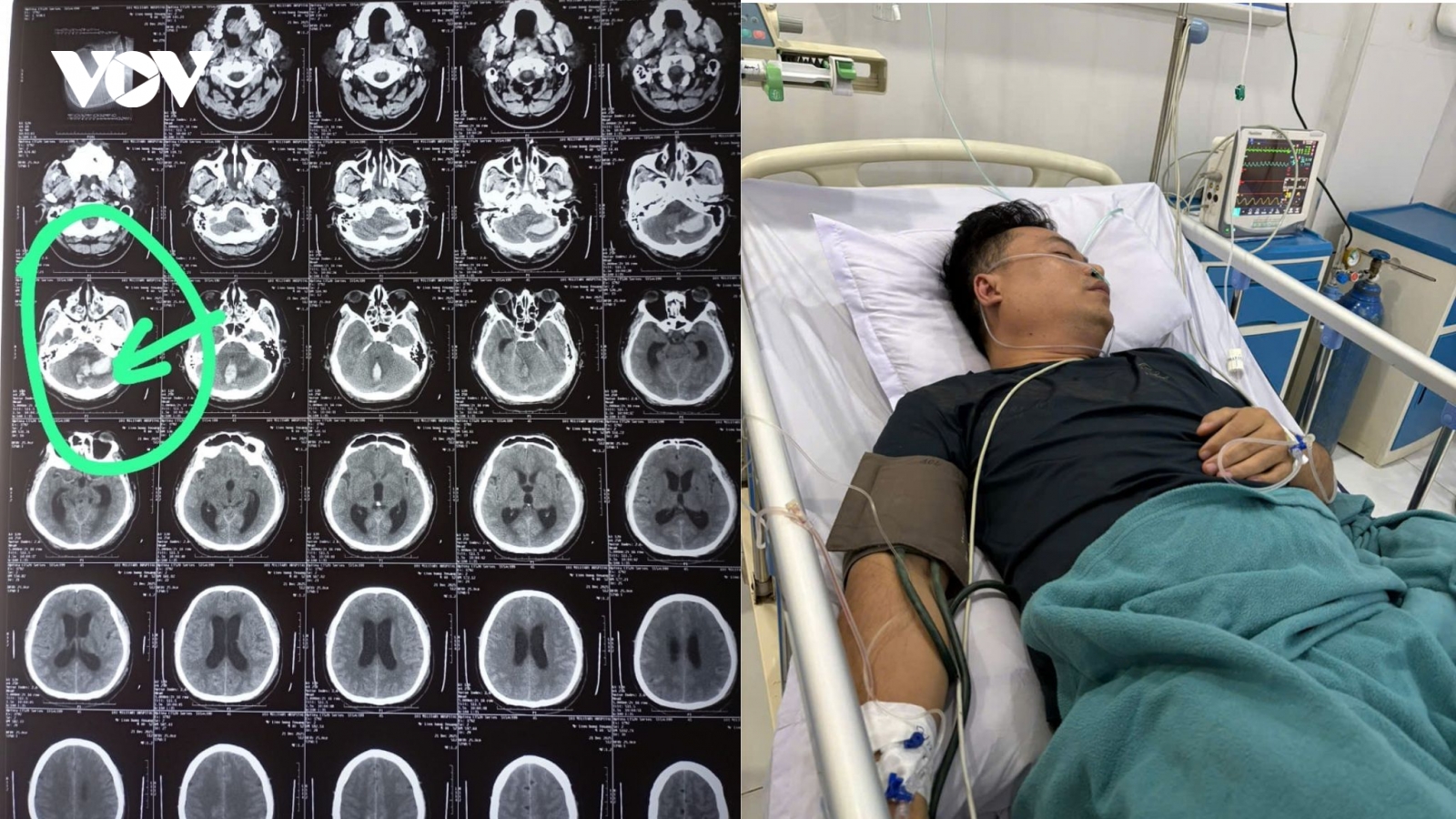 Vượt hơn 1.000km đưa chồng bị hôn mê sâu từ Lào về Việt Nam giành sự sống
