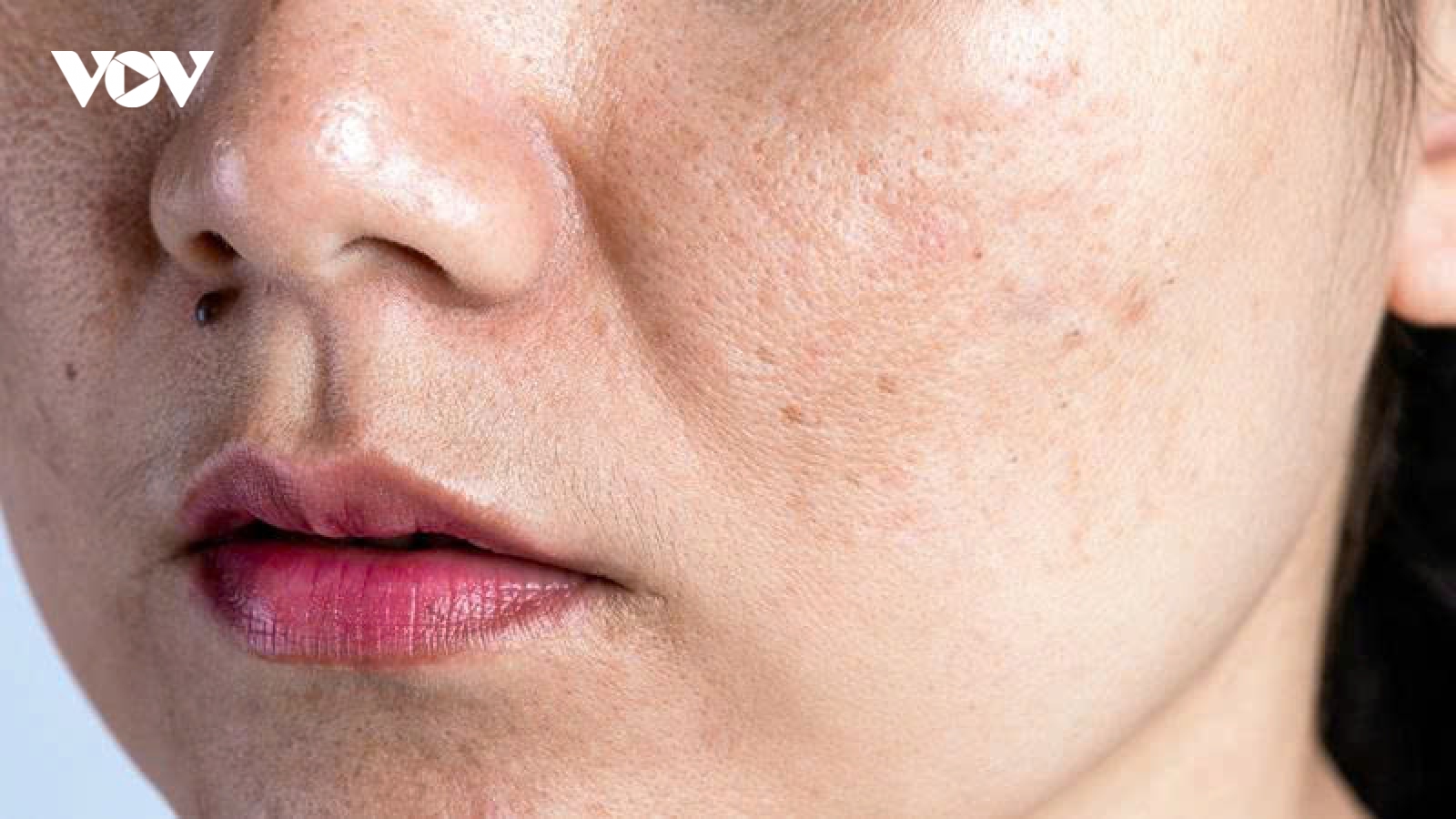 5 sai lầm mỗi ngày khiến da dễ nám hơn, nhiều chị em vẫn vô tình mắc