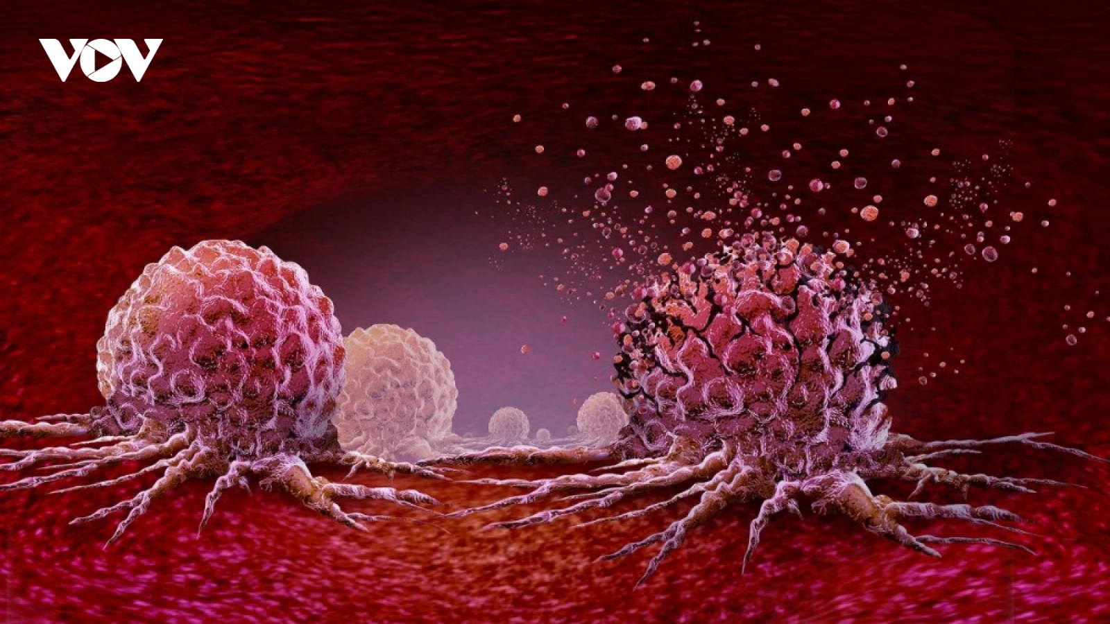 Công nghệ mRNA mở hướng mới chống ung thư tuyến tụy