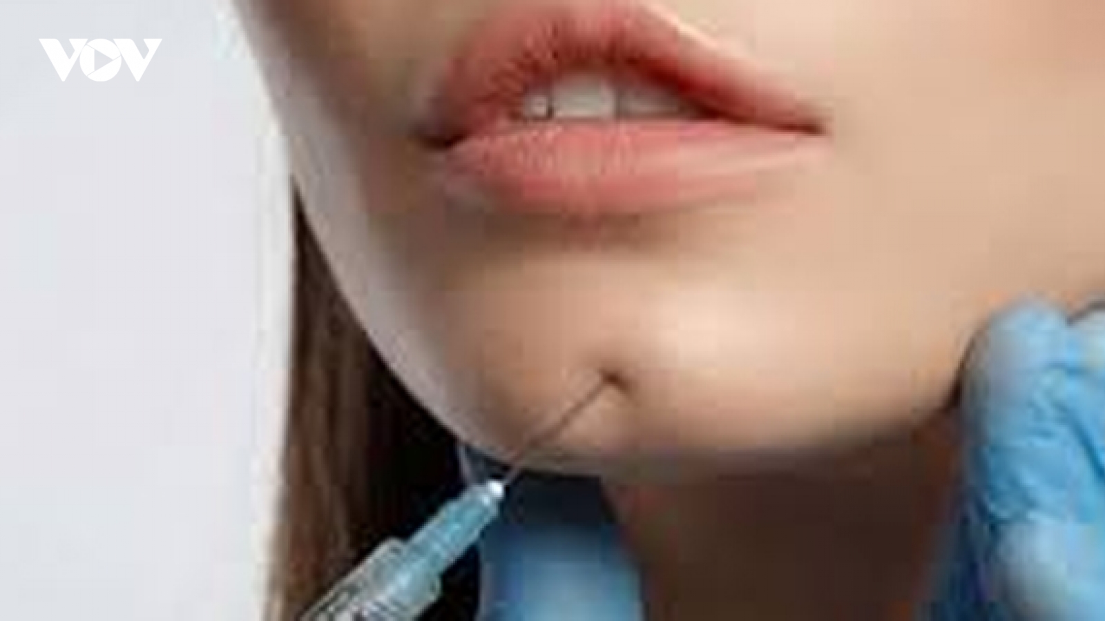 Bệnh viện Da liễu Trung ương cảnh báo bệnh nhân nhiễm trùng sau khi tiêm filler