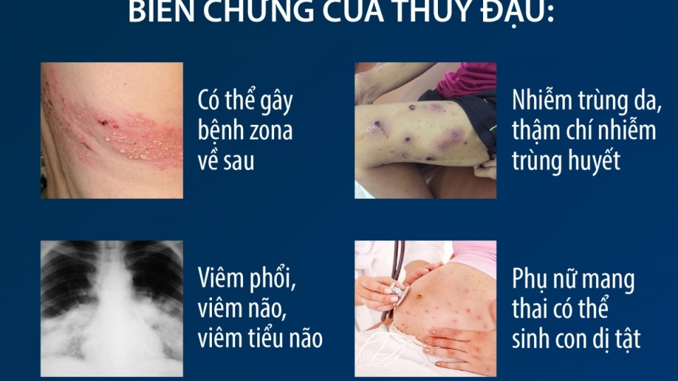 bien-chung-cua-thuy-dau.jpg