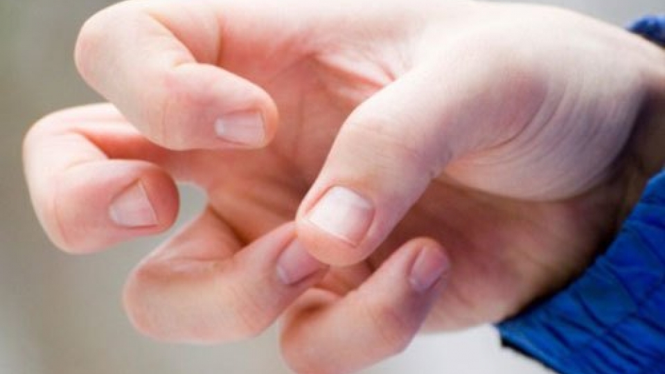Thuốc điều trị động kinh gây rối loạn kinh nguyệt