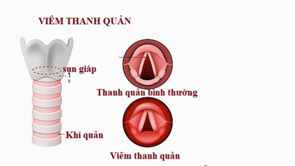 khan-tieng-01.jpg