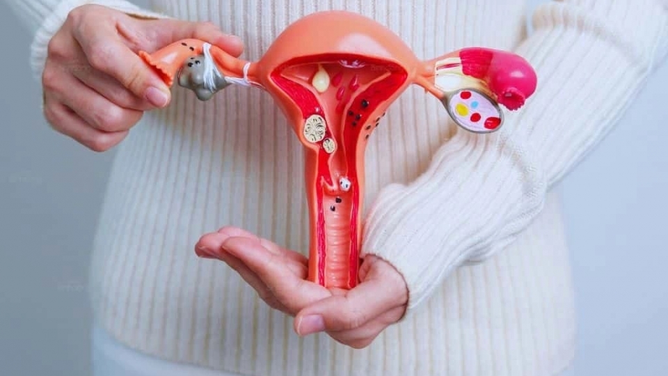 Điều trị viêm lộ tuyến tử cung xong có thể mang thai được không?