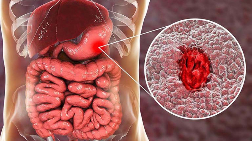 Xuất tinh ra máu có nguy hiểm không? Biến chứng tiềm ẩn?