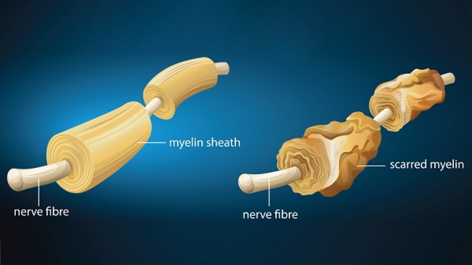 U80 lo lắng vì "cậu nhỏ" đột nhiên bị cong bất thường