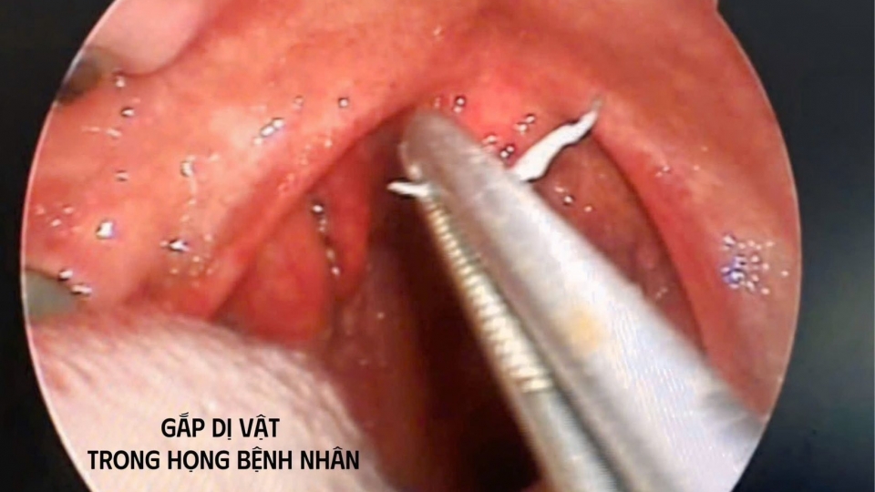 di_vat_trong_aimidan_3.jpg