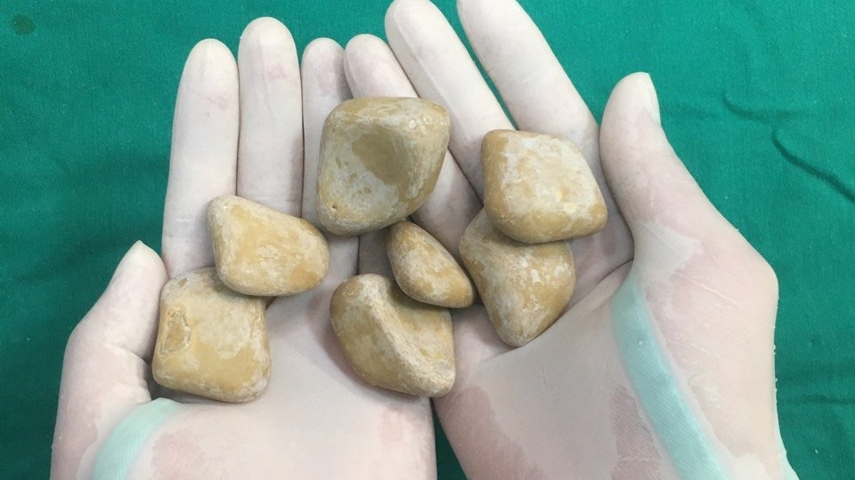 soi-o-bang-quang-1.jpg