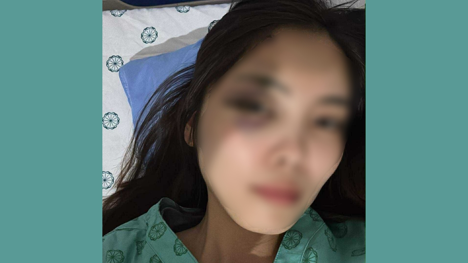 Người phụ nữ bị chồng hành hung dã man, nhập viện chấn động não.png