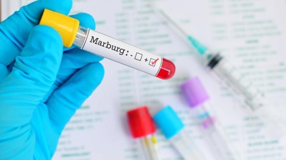 Ethiopia xác nhận sự bùng phát của virus Marbug gây chết người