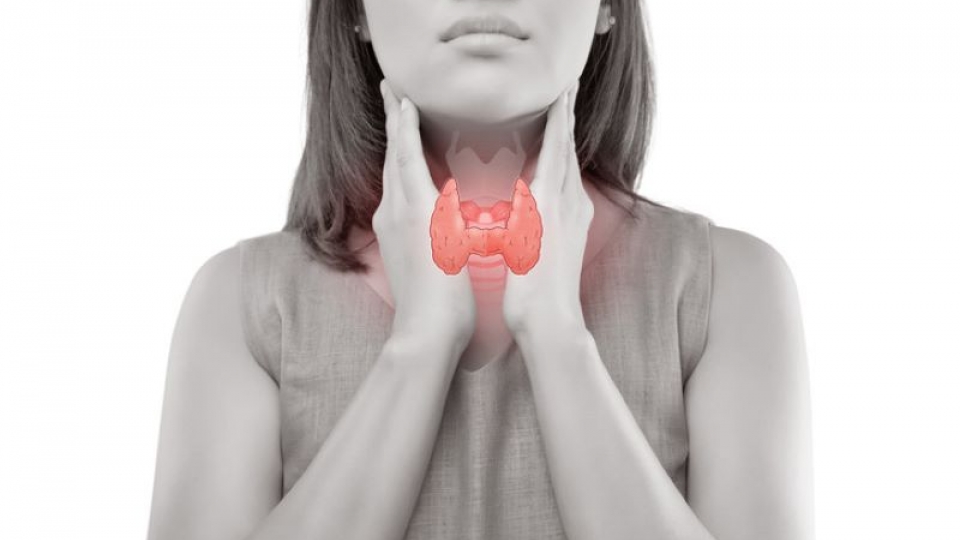 U cường giáp kèm thiếu máu do kinh nguyệt: Những lưu ý quan trọng khi dùng sắt