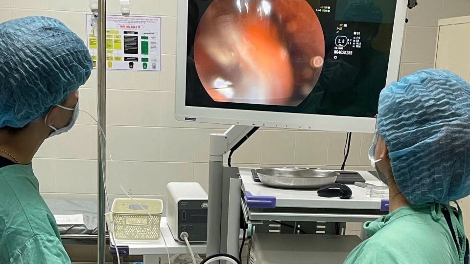 mot_ca_benh_hiem_gap_vua_duoc_cac_bac_si_benh_vien_trung_uong_hue_xu_tri_thanh_cong_bang_ky_thuat_noi_soi_can_thiep.jpg
