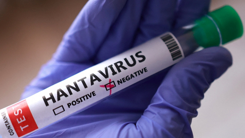 virus Hanta, ong xet nghiem virus, duong tinh am tinh -reu.jpg