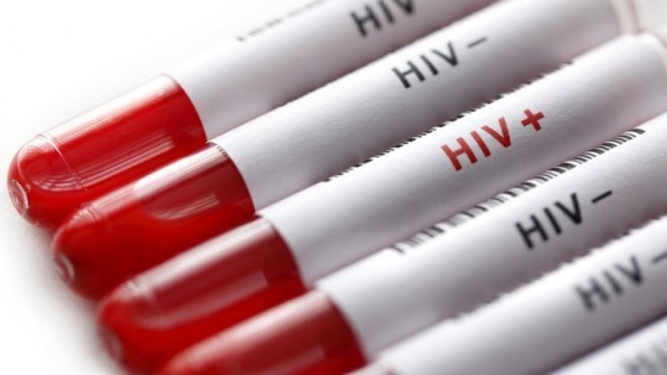 Vietnam keeps rate of new HIV cases lower 0.3%