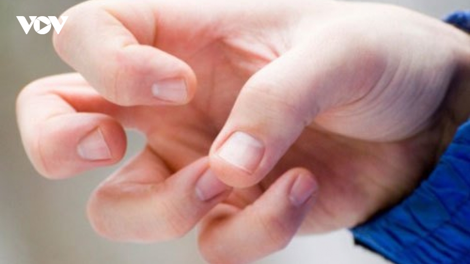 Thuốc điều trị động kinh gây rối loạn kinh nguyệt