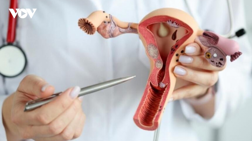 Cắt một bên buồng trứng có con được không?