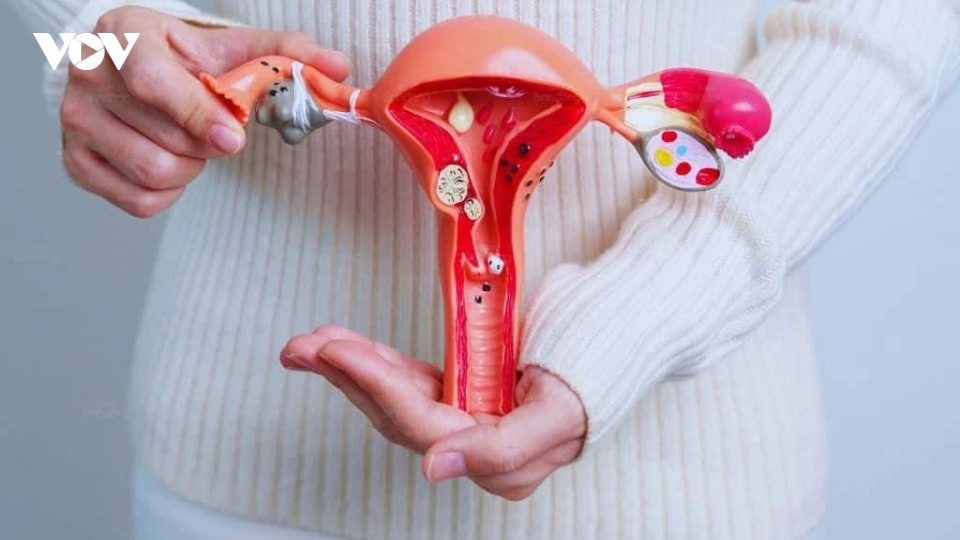Điều trị viêm lộ tuyến tử cung xong có thể mang thai được không?