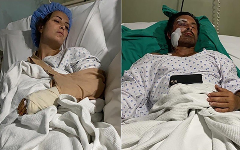 Lina Alameh (trái) và Imad Khalil (phải) nằm trên giường bệnh sau khi trải qua cuộc phẫu thuật. Ảnh: CNN.