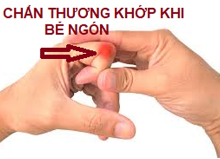 Bẻ khớp ngón tay- thói quen có hại!