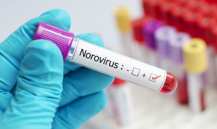 trung quoc hon 70 sinh vien nghi nhiem norovirus hinh anh 1