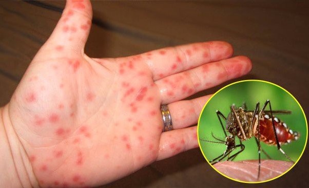 hanoi still at high risk of dengue fever spread despite decline in cases picture 1