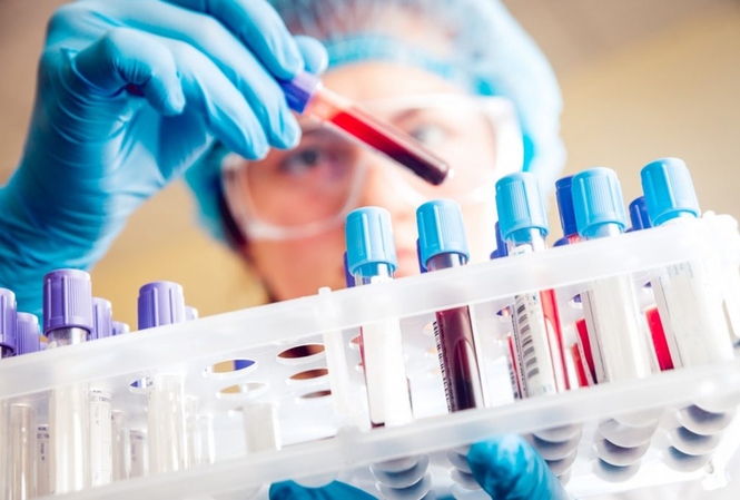 Korean expert tests negative for COVID-19: HCM City says