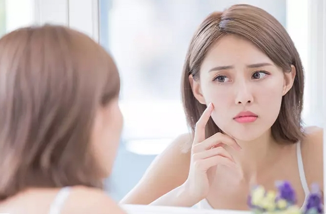 4 bí quyết vàng bạn nhất định phải biết để trị hết thâm mụn