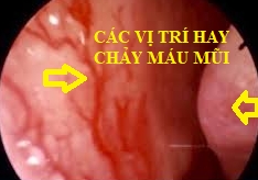  mua chay mau mui hinh anh 1