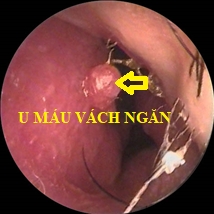 mua chay mau mui hinh anh 3