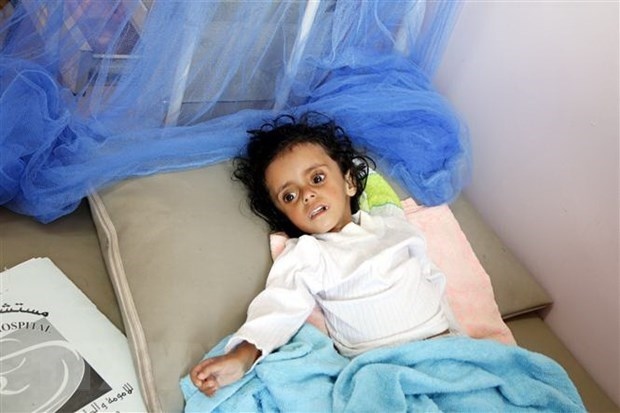 vietnam calls for joining hands in preventing famine in yemen picture 1