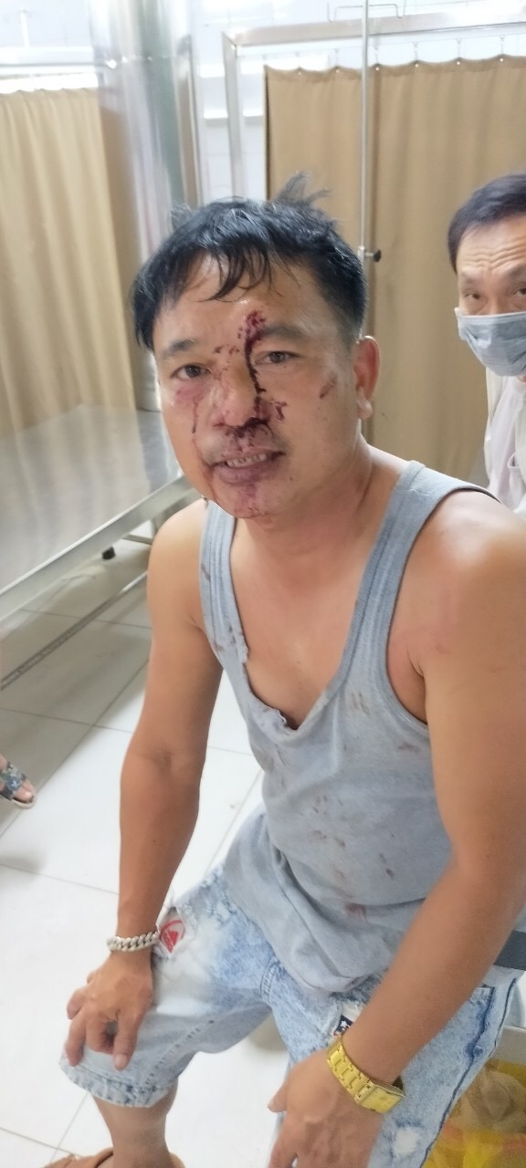 xử lý nghiêm nhóm côn đồ vô cớ hành hung người dân ở yên nghĩa, hà Đông hình ảnh 2 xu ly nghiem nhom con do vo co hanh hung nguoi dan o yen nghia, ha Dong hinh anh 2