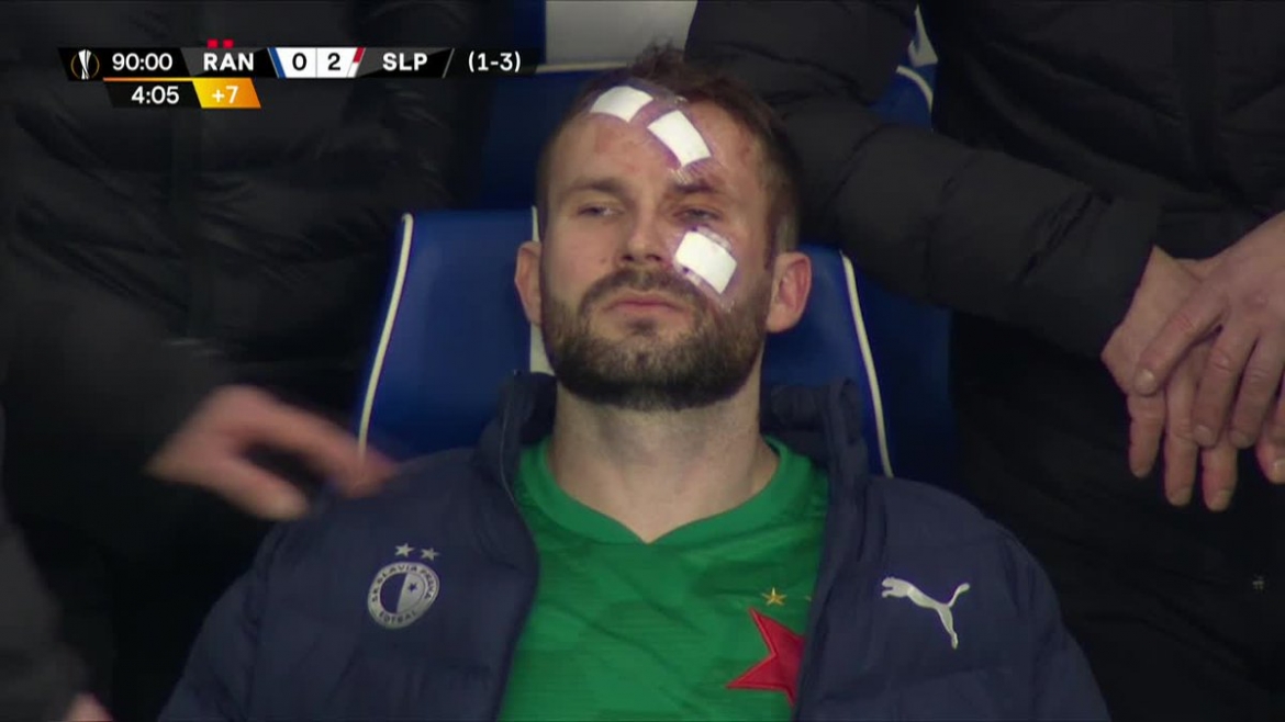 thu mon bi dap thang vao mat trong tran dau bao luc o europa league hinh anh 4