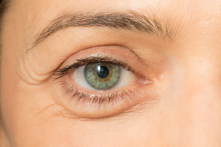 Giảm sưng mắt: Để sử dụng trà xanh làm giảm quầng thâm mắt, bạn hãy dùng hai túi trà lọc ướt chườm lên mắt trong vòng 15-20 phút. Trà xanh sẽ giúp làm dịu mắt và giảm thâm quầng nhanh chóng.