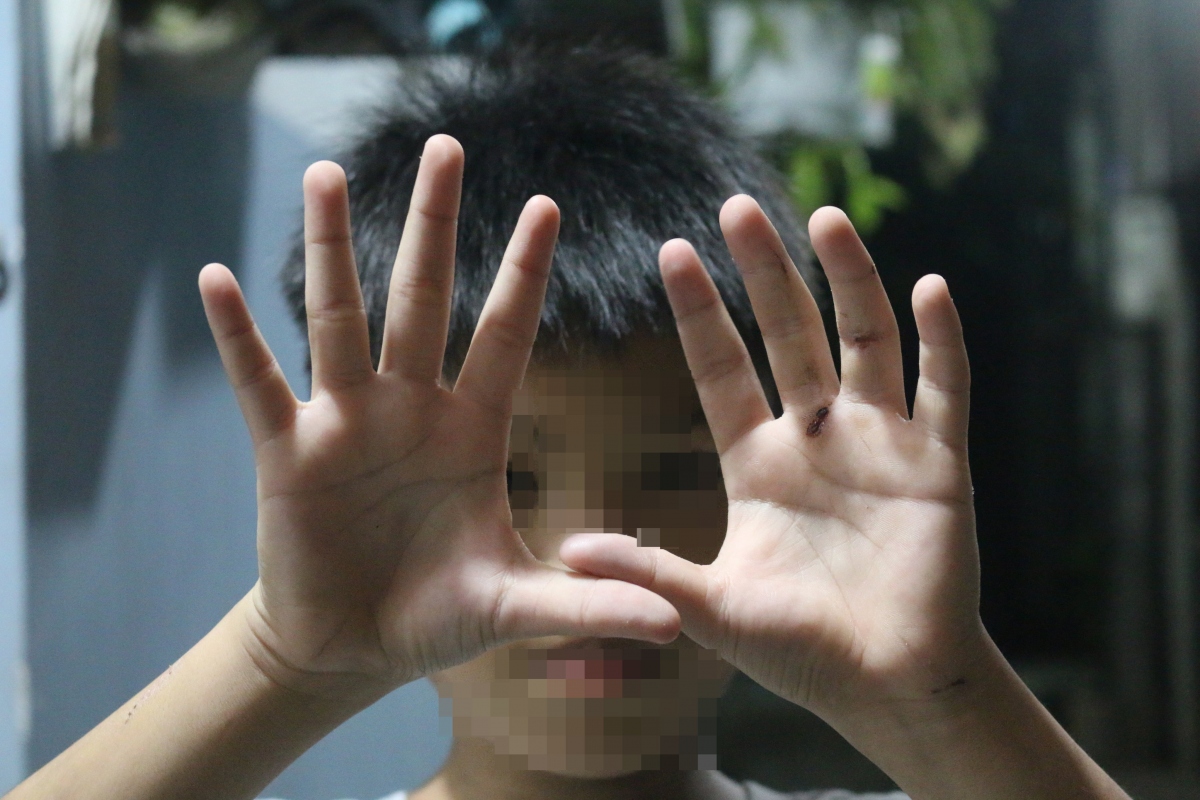 Có hay không bé trai ở Hóc Môn bị cha ruột đánh nát tay, bắt đi bán vé số?