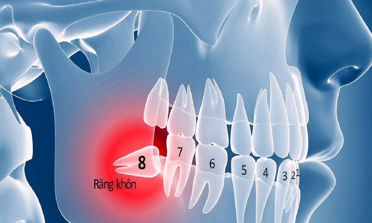 nho rang khon co the cai thien vi giac cua ban hinh anh 1