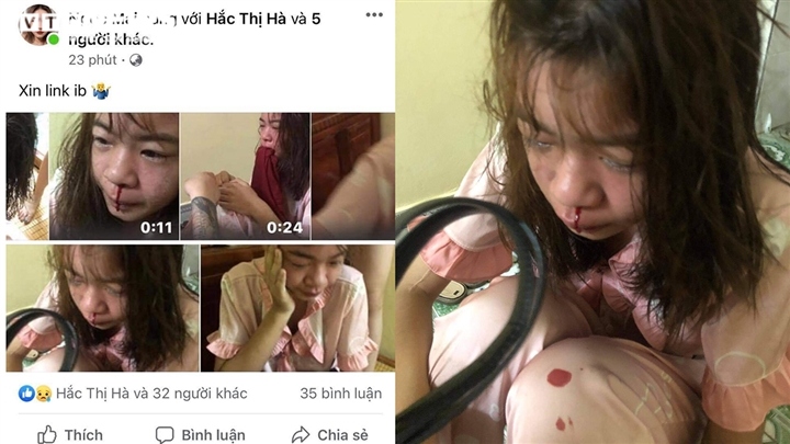 giai cuu khan cap thieu nu bi nhom ban tra tan nhu thoi trung co o thai binh hinh anh 4