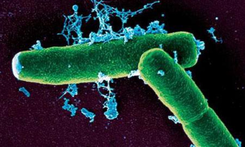 Vi khuẩn Bacillus anthracis gây ra bệnh than. Ảnh: CDC Trung Quốc