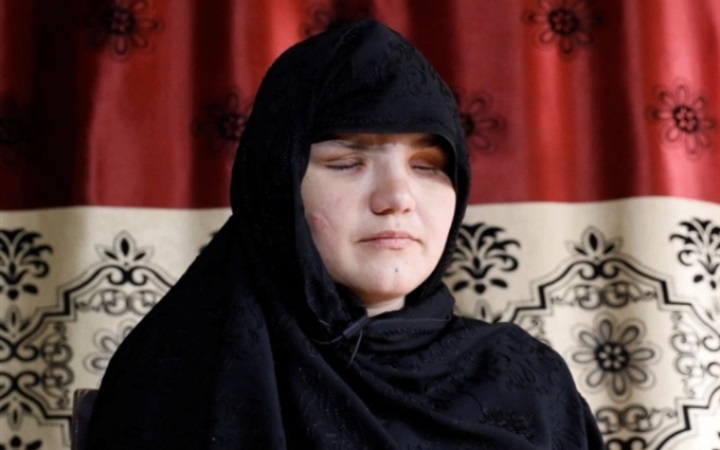 Khatera bị bắn 8 phát và bị phiến quân Taliban khoét mắt. (Ảnh: Reuters)