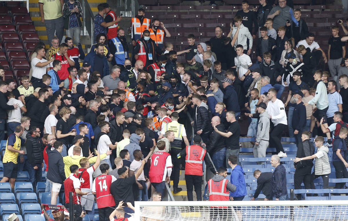 CĐV Arsenal đổ máu sau trận đấu với Burnley - Ảnh 2.