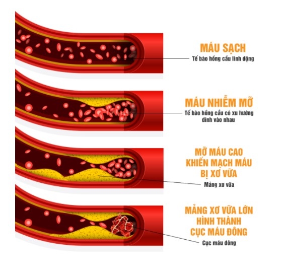 Cách lưu thông mạch máu để giảm mỡ máu và cholesterol?
