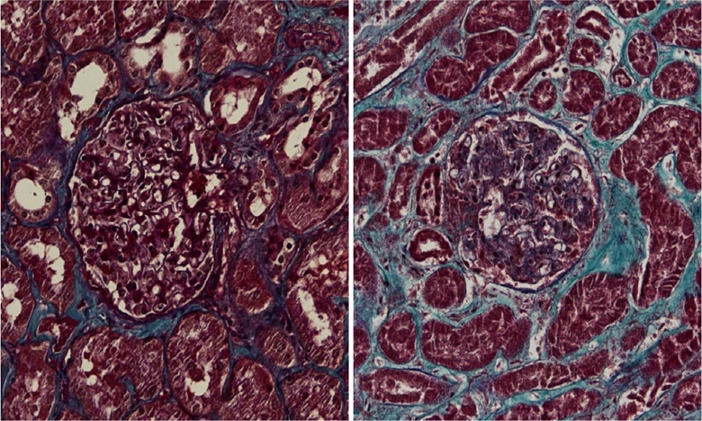 virus sars-cov-2 tan cong than va hinh thanh seo hinh anh 1