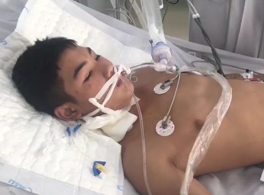 Một trong 2 bệnh nhân Nam giới đang được các bác sỹ tập cai máy thở để chuẩn bị bỏ hẳn thở máy.