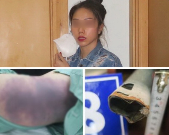 Bị can Nguyễn Võ Quỳnh Trang và các dấu vết bạo hành cháu gái 8 tuổi - Ảnh: CACC