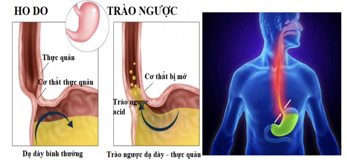 ho keo dai that bat tien moi nguoi tuong mac covid hinh anh 2