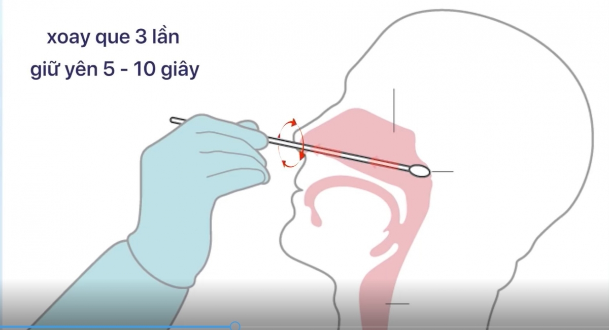 Hướng dẫn test nhanh Covid-19 tại nhà chuẩn theo Bộ Y tế