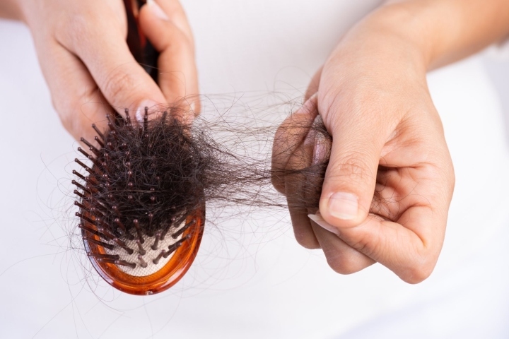 Rụng tóc ở nam giới tuổi 30 Nguyên nhân và cách khắc phục  Phòng khám Da  liễu thẩm mỹ Bác sỹ Thái Hà