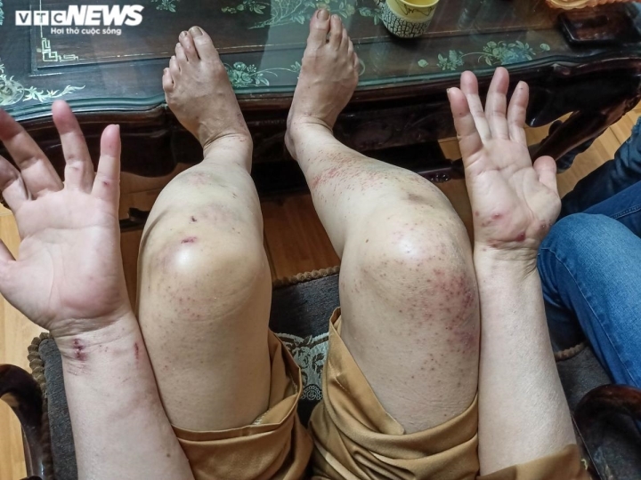 nguoi phu nu roi xuong vuc 7 ngay o yen tu toi khong len nui de tu hinh anh 3