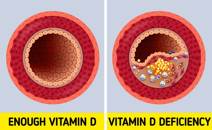 dau hieu canh bao ban dang thieu vitamin d hinh anh 3